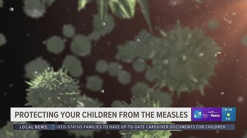 Vaccines play important role in protecting children from the Measles