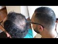 How to Cut and Fade Balding Hair