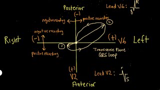 Schneid Guide to the QRS vectorcardiogram loop