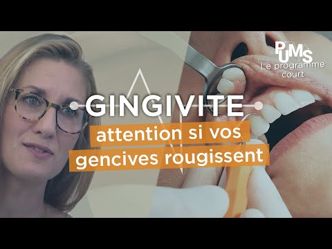 Vidéo: 3 façons de guérir la gingivite