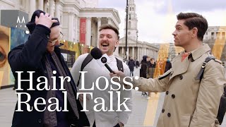 Street Talk: Men Open Up About Hair Loss! by Robin James 10,023 views 2 months ago 4 minutes, 56 seconds