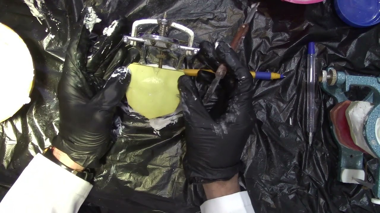 Mounting by using simple articulator