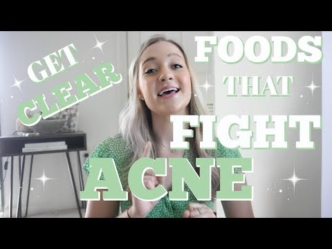 IS YOUR DIET CAUSING YOUR ACNE?? | Foods to Get Rid of Acne | Callie Hagen