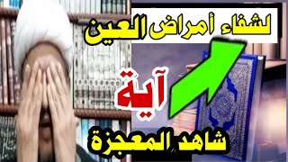 شاهد المعجزة آية لشفاء أمراض العين تماما؟؟؟✅👆✅