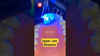 Upper jaw retainer #shortvideo #shorts #retainers #orthodontics #bracesoff