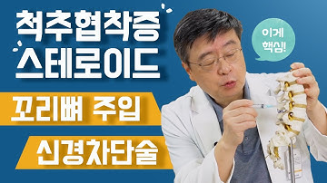 허리신경차단술과 꼬리뼈를 통한 스테로이드주사 치료, 협착증비수술 치료 알려드립니다!