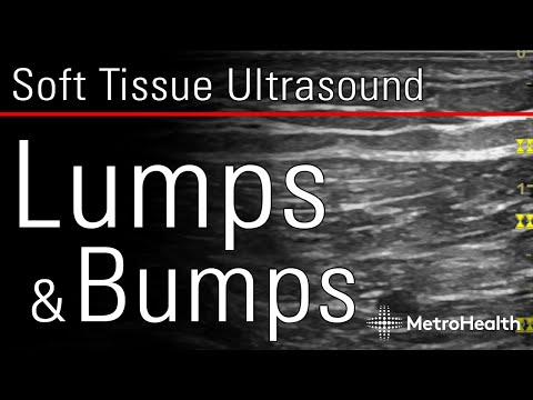 Soft Tissue Ultrasound: