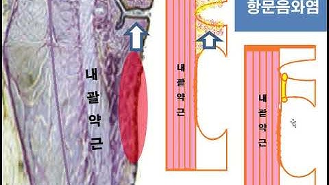 치열 열항  알기쉬운 의학강좌 서인근박사