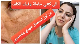 علاج الكلفالنمش_تصبغات الوجه_حروق الشمس(وصفة سرية و حصرية للحوامل الكلف امشي ليك نهار ولادتك)