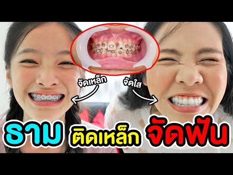 ธามติดเหล็กจัดฟัน เจ็บมั๊ย?! | Q & A พี่เฟิร์น 108Life