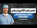 Benefits Of Laparoscopic Surgery (Special For Ladies) Laparoscopic Surgery Kay Fawaid | Laparoscopy