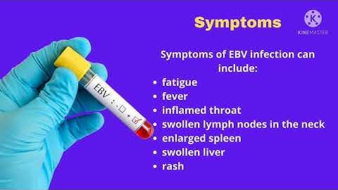 Natural  solution  for EBV infection/ epstein barr virus  by Dr.ighodalo