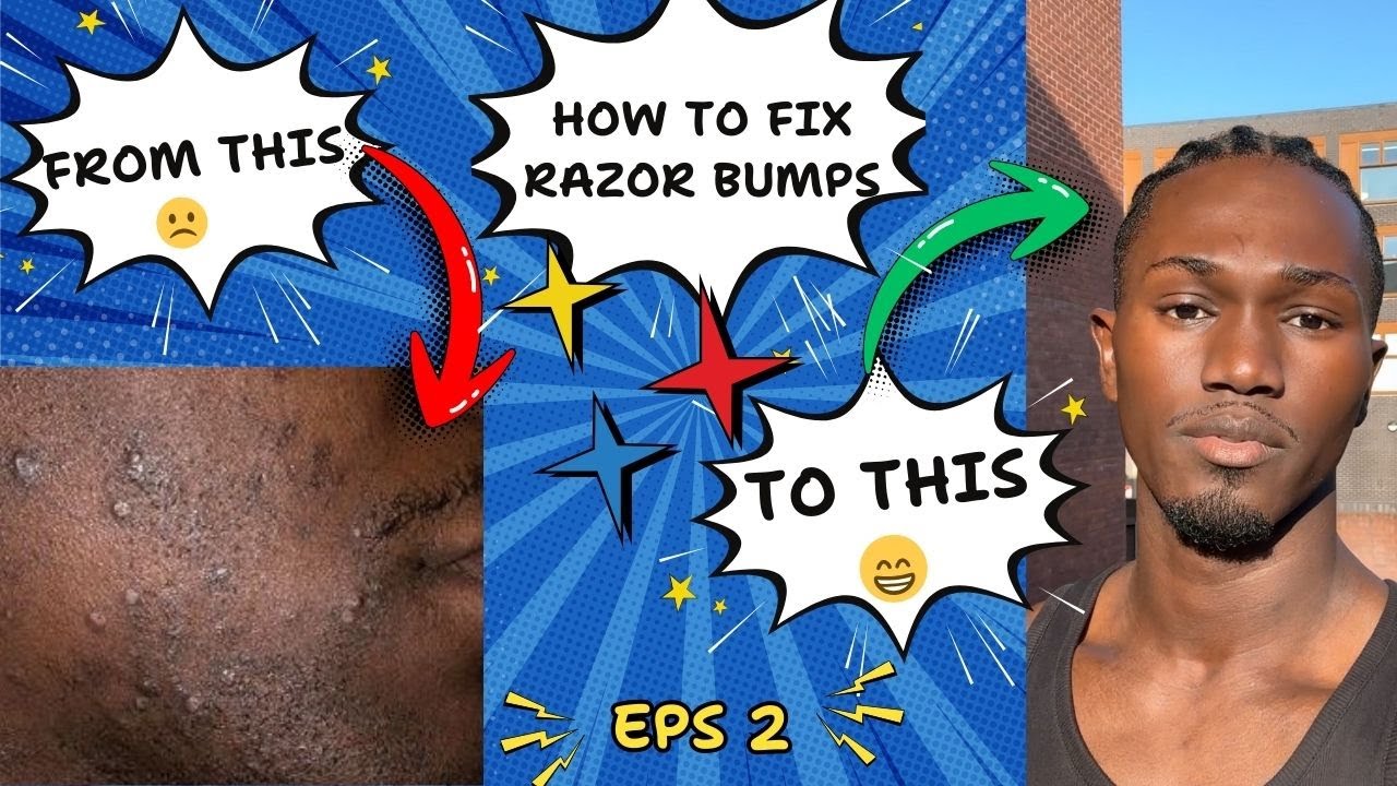How to prevent Razor Bumps & Ingrown hair.