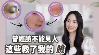 擦什麼都沒用😥 用這些皮膚才救回來@DrGrace by Dr. Grace 117,769 views 5 days ago 11 minutes, 56 seconds