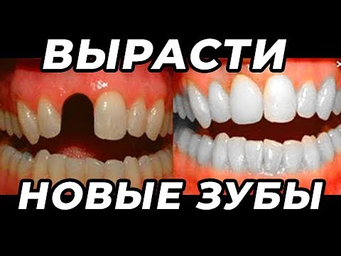 Как Вырастить Новые Зубы? Об Этом Не Расскажут Стоматологи