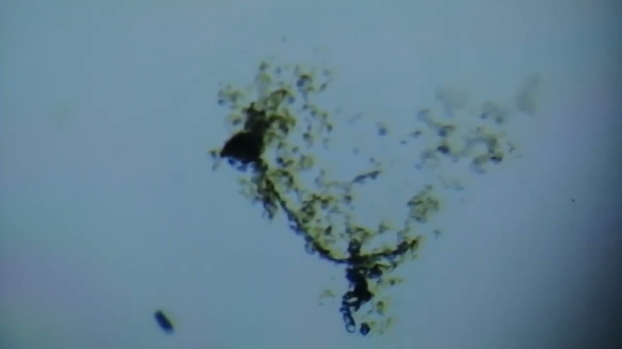 فيديو يوضح ظاهرة البلزمة او الانكماش