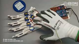 ERRB051 || Prosthetic Hand Using Single Flex Sensor || Inspire Award Project || #ProstheticHand