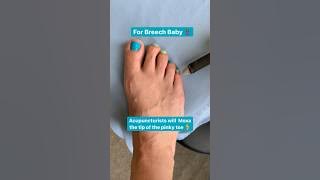 Moxa Therapy for Breech Baby #alternativemedicine