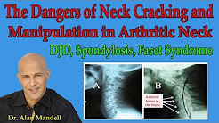 Dangers of Neck Cracking and Manipulation in Arthritic Neck (Spondylosis, DJD) - Dr Mandell