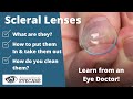 Scleral Lenses: What They Are & How to Use Them