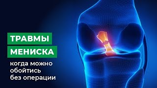 Травмы мениска - когда можно обойтись без операции