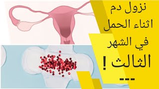 نزول دم اثناء الحمل في الشهر الثالث ما هي الاسباب تعرف عليها الآن nozol dam fi chahr 3