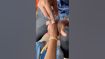 Iv injection procedure 💉#mbbs #doctor #injection #sortfeed #sorts