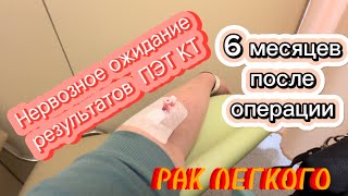 #58 РАК ЛЕГКОГО. Нервозное ожидание результатов ПЭТ КТ. 6 месяцев после операции.