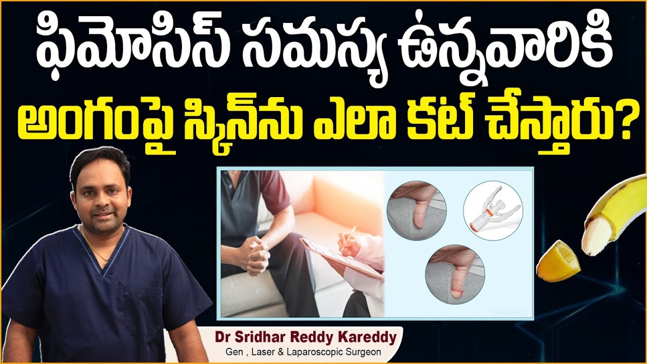 ఫిమోసిస్ కు సున్తీ Stapler Circumcision Procedure in Telugu