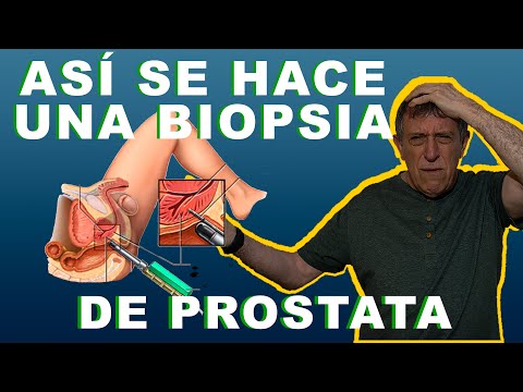 Vídeo: Biopsia De Próstata: Indicaciones, Complicaciones