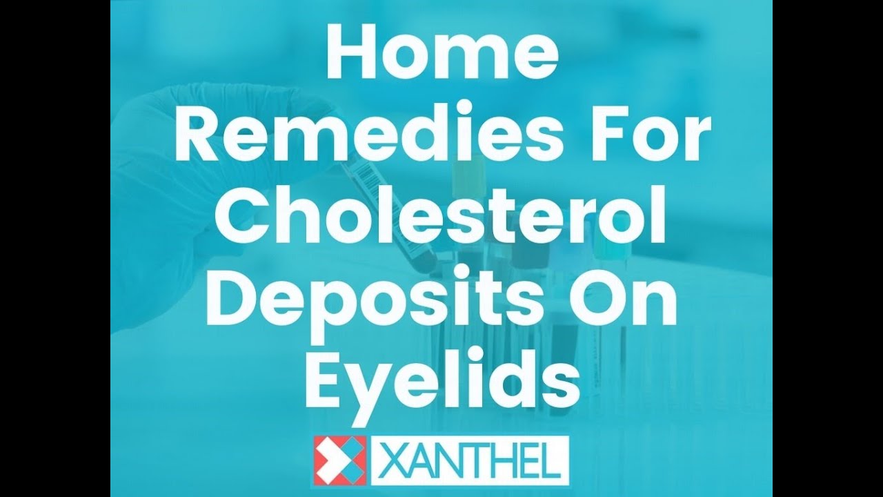 Home Remedies For Cholesterol Deposits On Eyelids Brought To You By