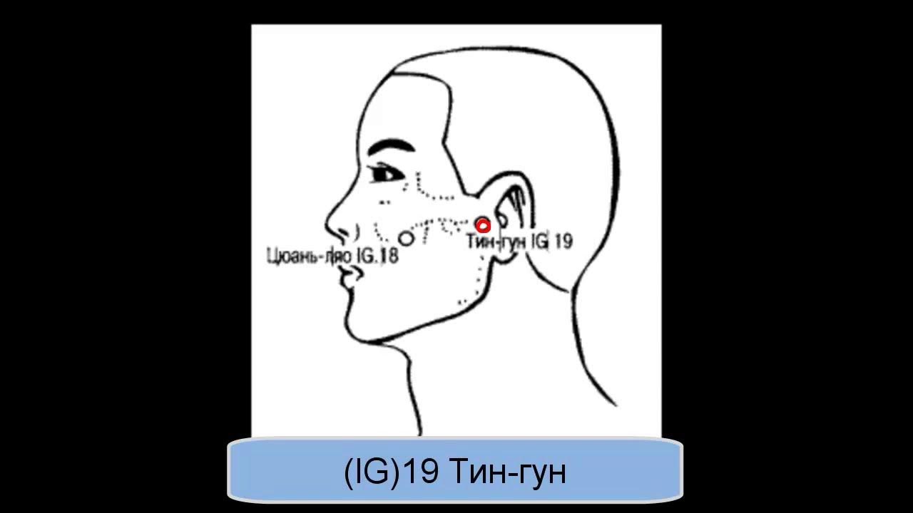 Точка ти джи. Ig 18 точка акупунктуры. Акупунктурная точка ig68. Ig-19. Тин-Гун. Цюань Ляо точка на лице.