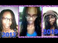 MY NATURAL HAIR JOURNEY / MIMI BRAIDS / HAIR GROWTH JOURNEY PRESENT