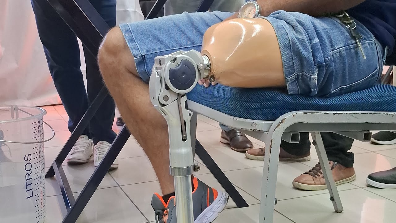 Avaliação paciente protetizado durante curso de prótese Transfemoral 