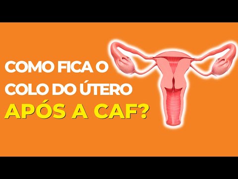 Vídeo: Você pode ter um bebê após uma traquelectomia?