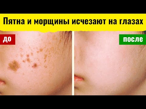 Маски для лица с корицей от морщин и пигментных пятен. Рецепты в домашних условиях