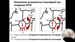 Ходунов О.Б. Аритмии и блокады сердца(Нарушения ритма сердца)