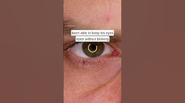 What is the world record for not blinking? 👀 How long can you last?