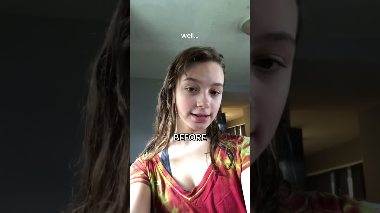 this is your sign to work on yourself 👏🏻 #glowup #skincare #transformation