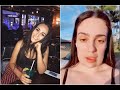 Fat removal procedure leaves woman with rectangle face