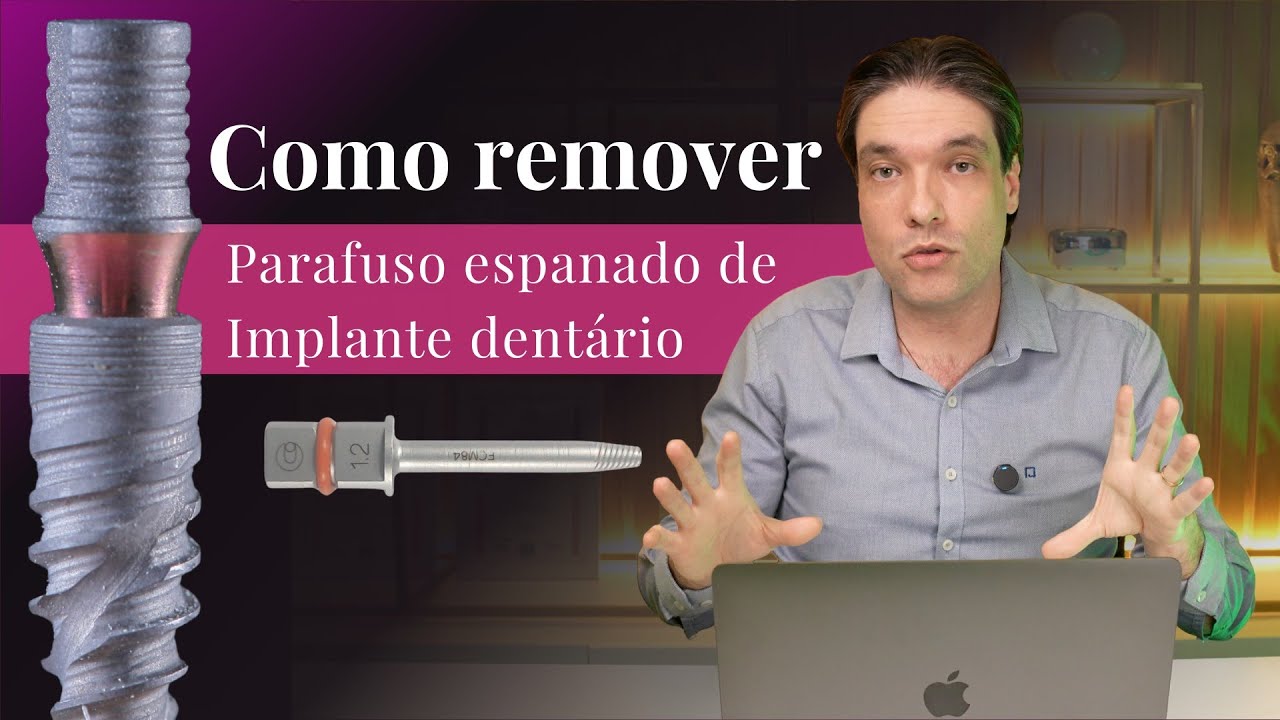 Como remover parafuso espanado em implante dentário?