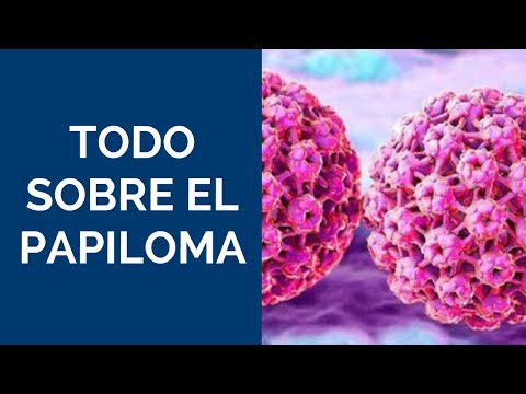 virus del papiloma humano se puede curar