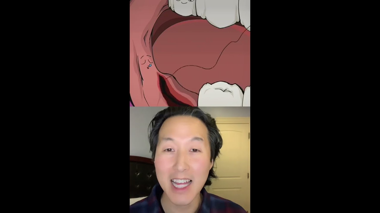 How Wisdom Teeth Are Removed Shorts Wisdomteeth
