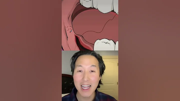 How Wisdom Teeth Are Removed #shorts #wisdomteeth