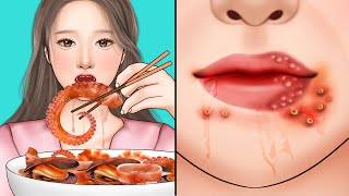ASMR Mukbang acne extract around mouth corner | Pimple popping animation
