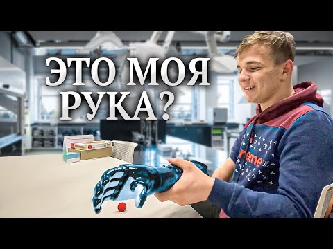 ПОДАРИЛИ РУКУ ПАРНЮ ИЗ ДЕРЕВНИ.ДИМА ВСЁ ПОТЕРЯЛ.