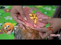 Amazing Style Videos!!! Dandruff And Biggest Worms Alive On Scalp By Sister Hand #488