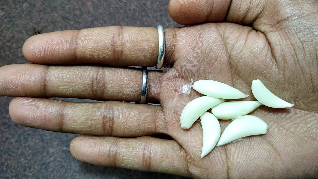 2 मिनट में दांत का दर्द खत्म हो जाएगा ! Tooth pain ! dant dard ka ilaj - YouTube