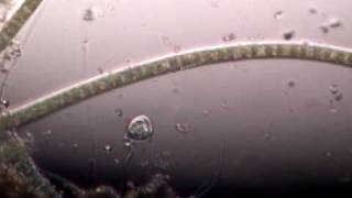Pond life under microscope