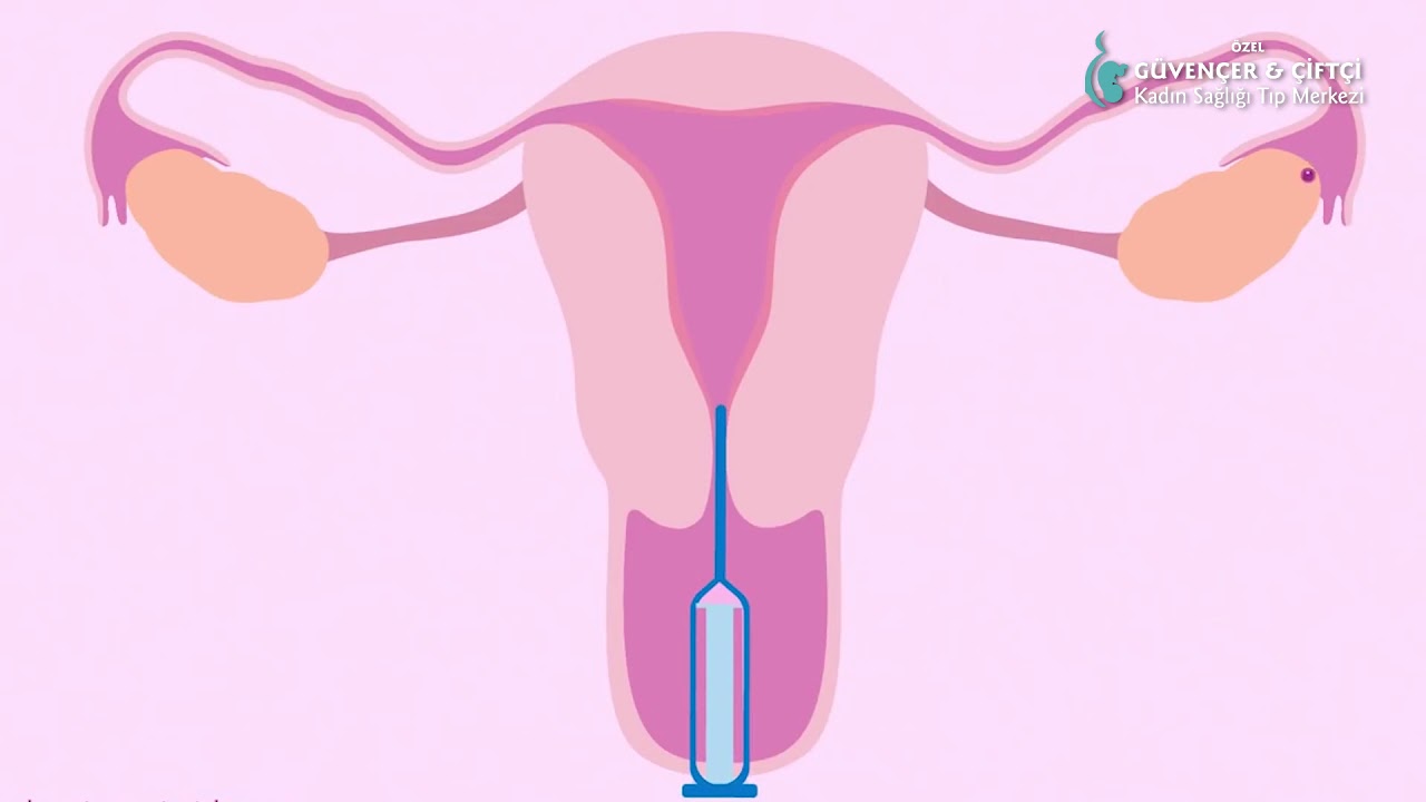 Aşılama - Güvençer Çiftçi Kadın Doğum Sağlığı Tıp Merkezi